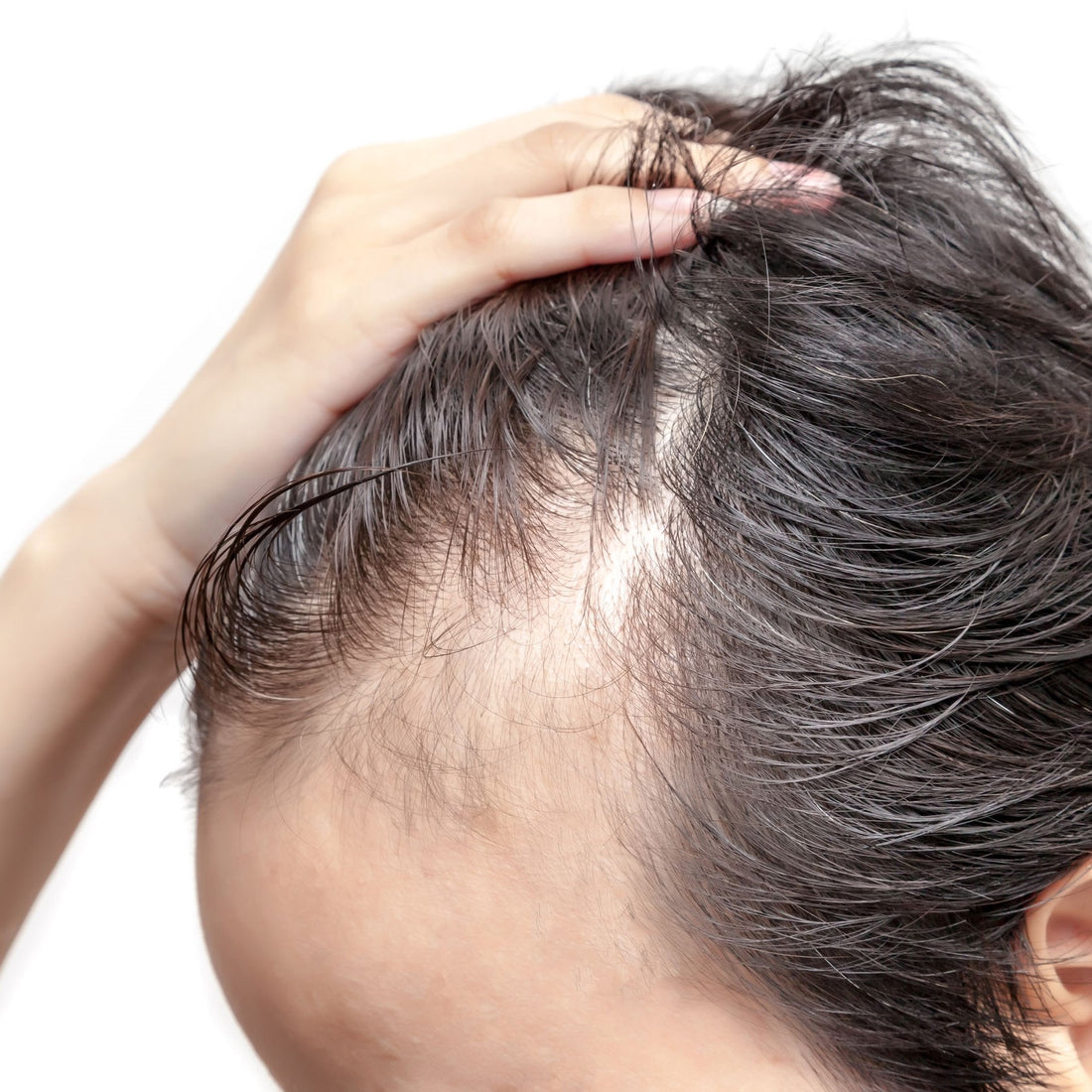 Man with receding hairline