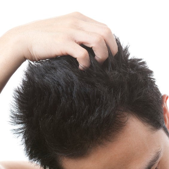 A man moves his fingers through his dry hair
